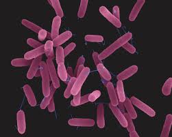 Gram negative Pseudomonas aeruginosa (Gram negative)